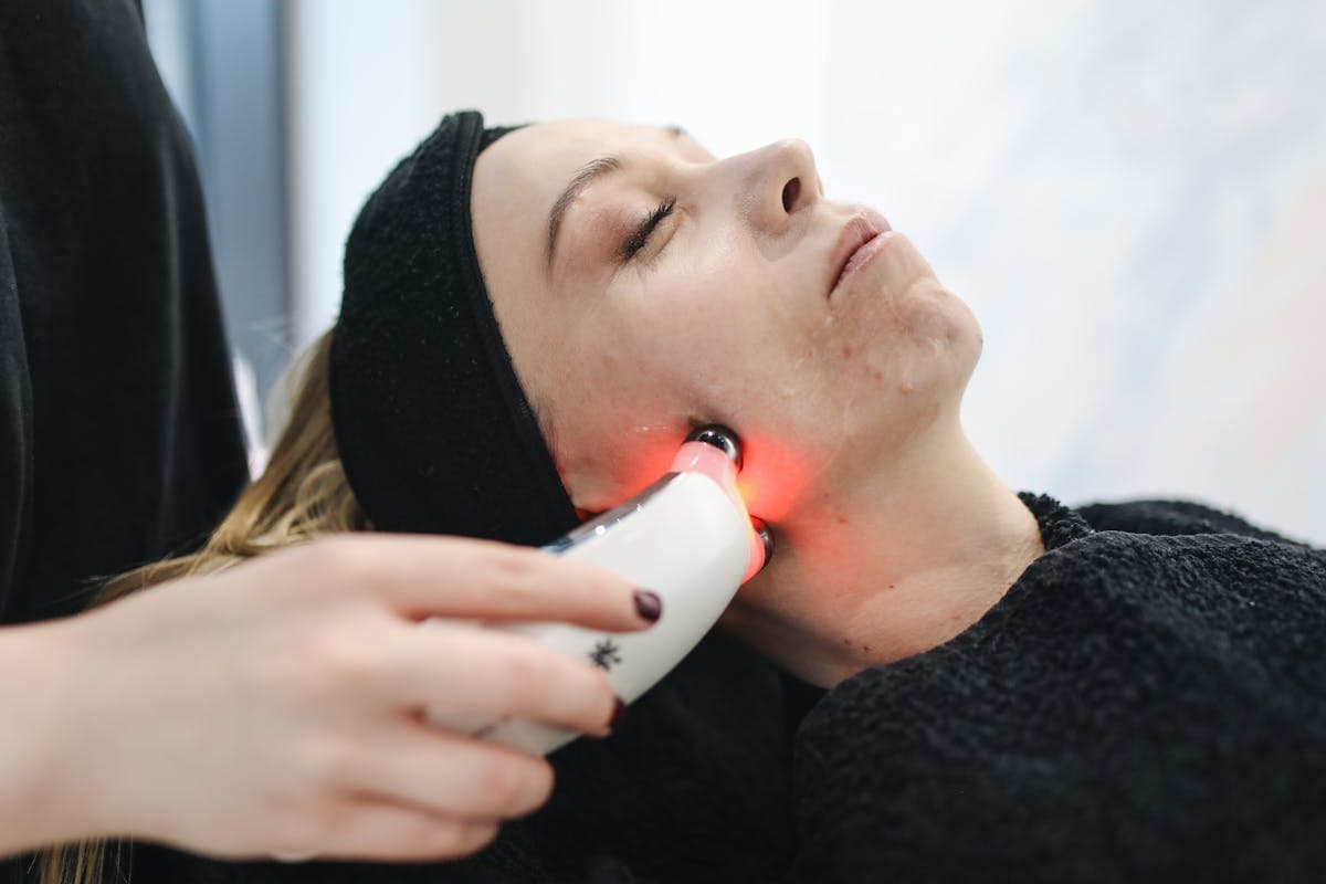 Energy-Based Skin Treatments in Sydney: Why RF Microneedling, Laser & LED Are Replacing Fillers in 2026